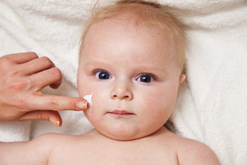 Bôi kẽm dưỡng da vào 2 má cho bé